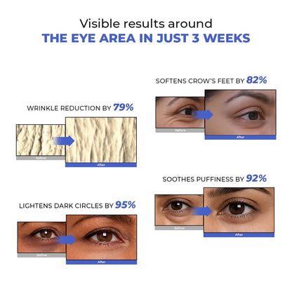 Retinol Peptide Eye Treatment Serum | 15 ml | Flash Sale