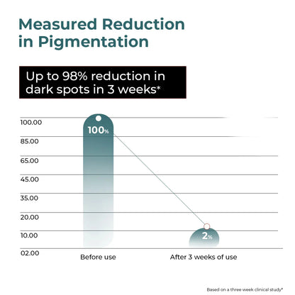 Trubiom Pigmentation & Dark Spots Treatment Serum | 30 ml