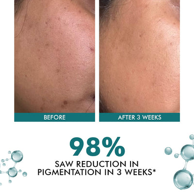 Trubiom Cream Mini | Special Deal