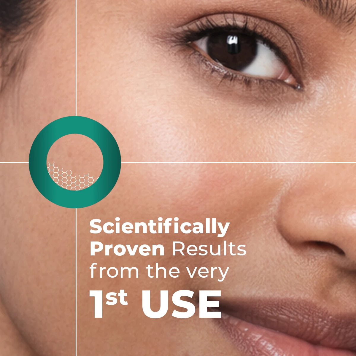 Acne Spot Corrector Gel | 15 ml