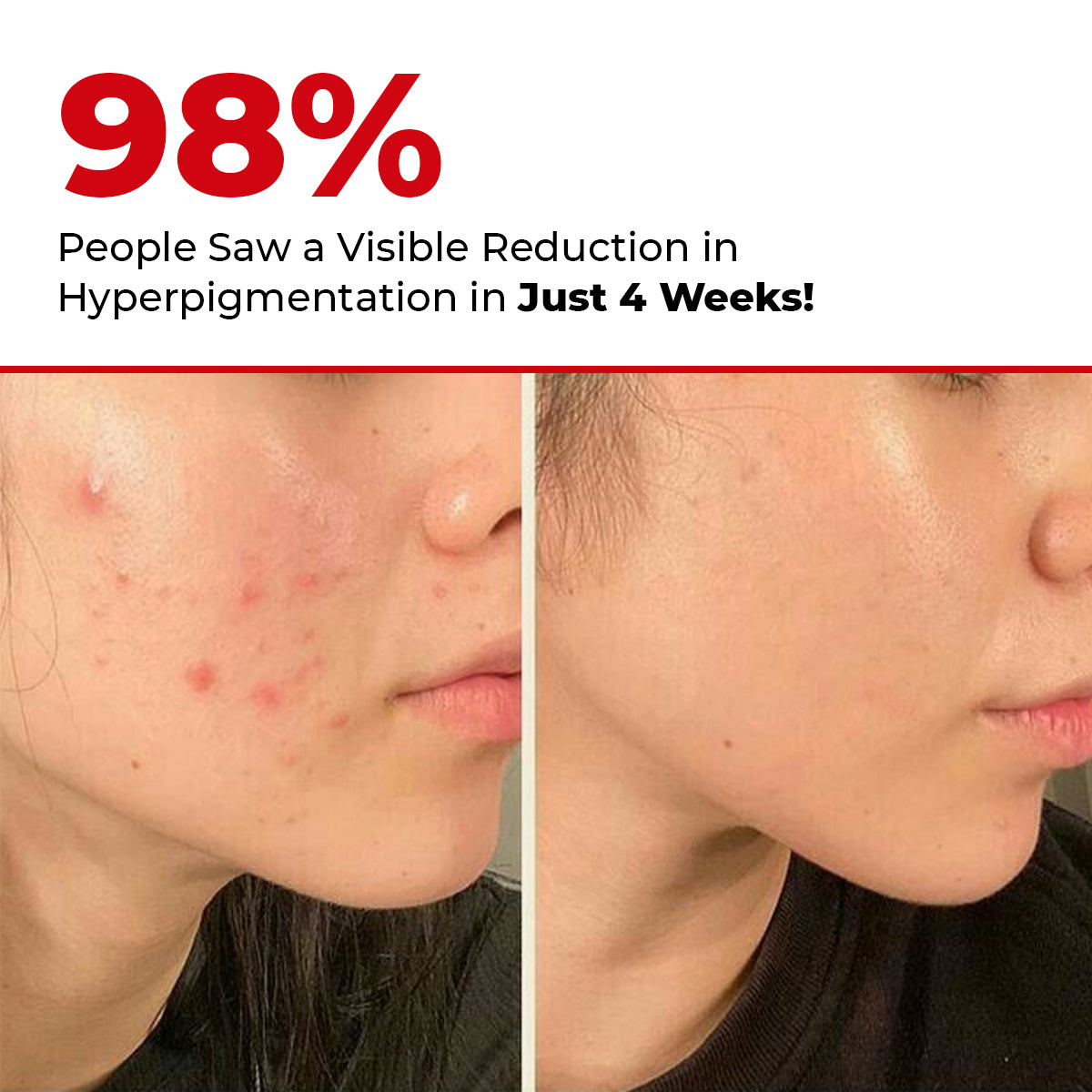 5 Antioxidant Skin Brightening Serum| 5 Antioxidants | 50 ml