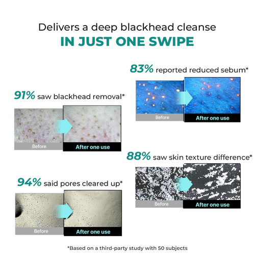 Blackhead Melting Water