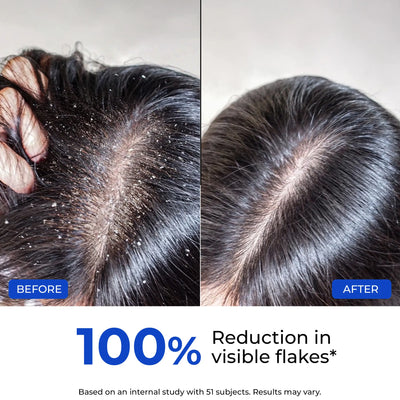 Anti-Dandruff Ultra Hydrating Conditioner | Supersaver Sale