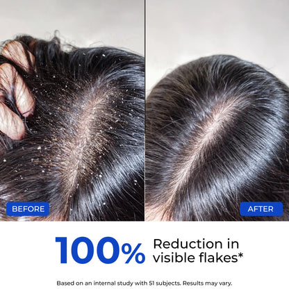 Anti-Dandruff Ultra Hydrating Conditioner
