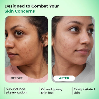 100% Mineral Sunscreen SPF 50 PA++++ | pronto