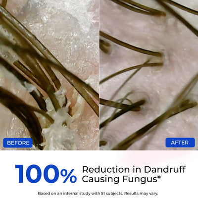Scalp Relief Anti-Dandruff Shampoo