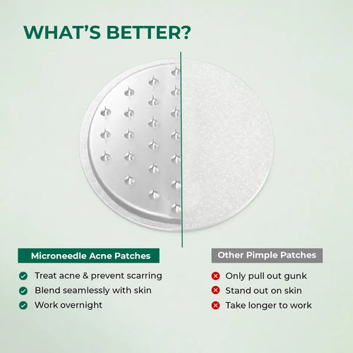 Self Dissolving Microneedle Acne Patches | 8 Patches | Flash Sale