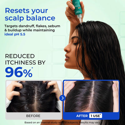 Anti-Dandruff Scalp Exfoliator | Supersaver Sale
