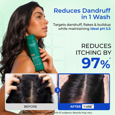 Scalp Relief Anti-Dandruff Shampoo