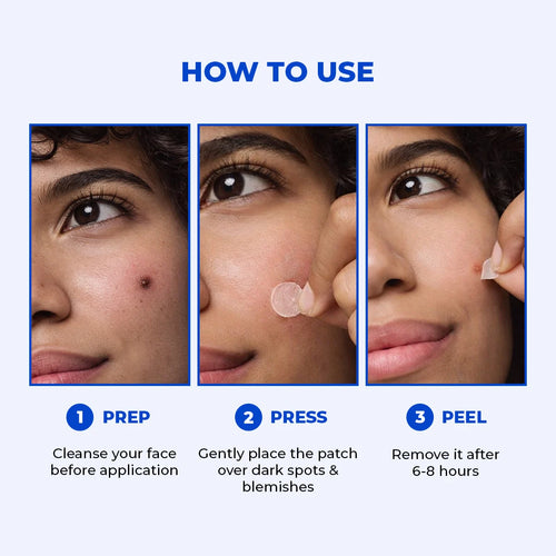 Microneedle Patch For Dark Spot Removal | 4 Patches | Flash Sale