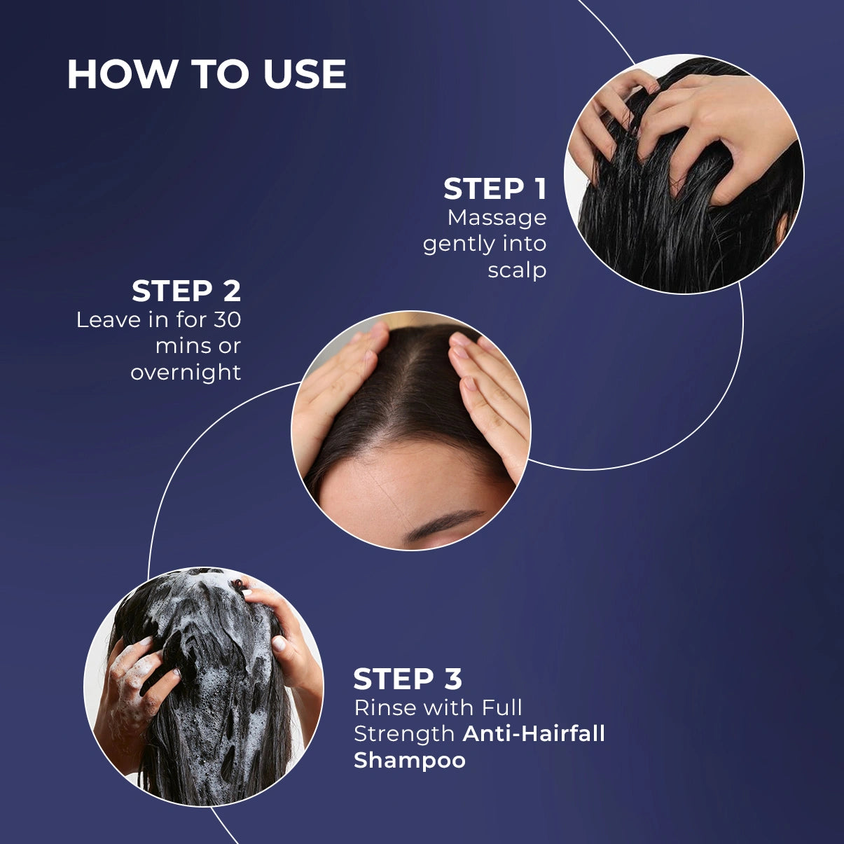 Rosemary Hair Growth Oil | 100 ml