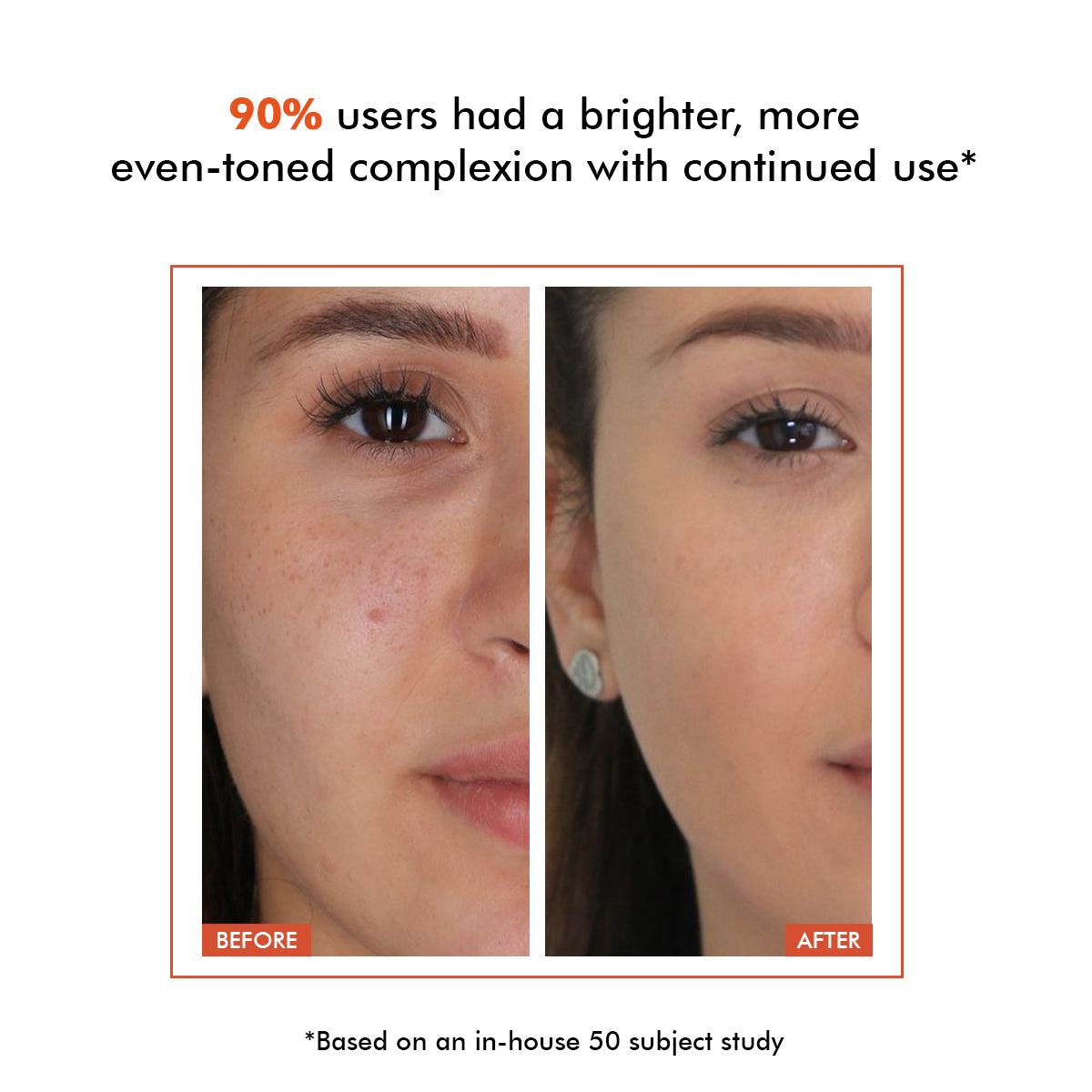 Vitamin C Sunscreen | SPF 50 PA++++ | Zero Whitecast | 50 gm