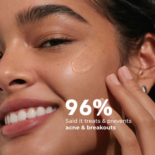 FlashFix Acne Treatment Serum | 2% Salicylic Acid & Willow Bark | 30 ml | Flash Sale