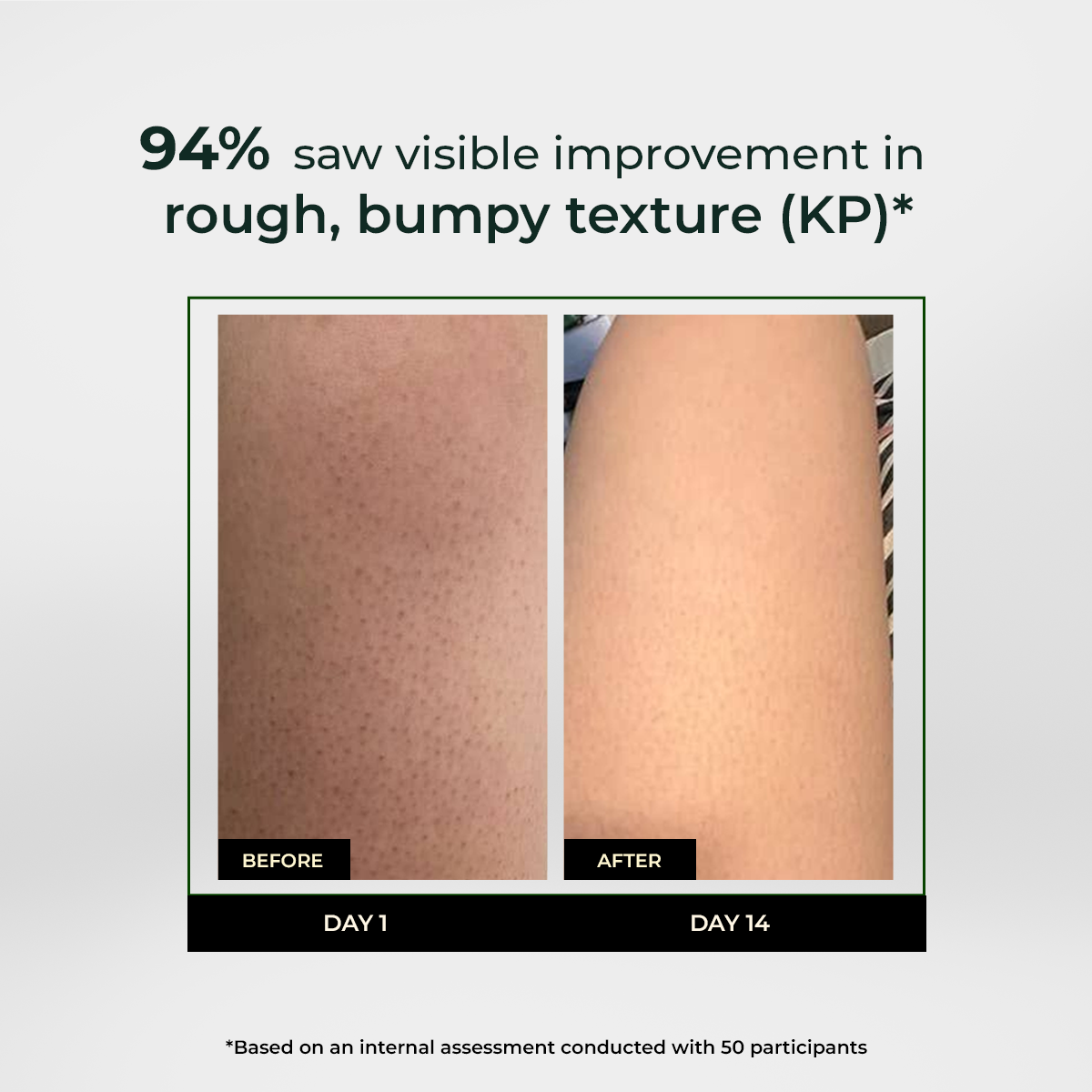 Skin Reset Exfoliating Bodywash | 300 ml