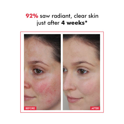 Derm Date Resurfacing Chemical Peel Treatment Serum