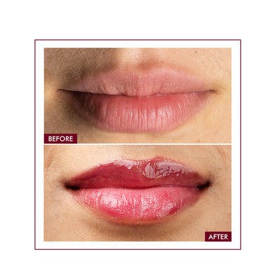 Glossy Peptide Lip Balm | 12 Hrs Hydration | 15 gms | Best Deal