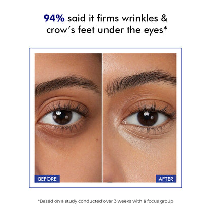 Eye Treatment Serum | Treats Dark Circles & Fine Lines | 15 ml
