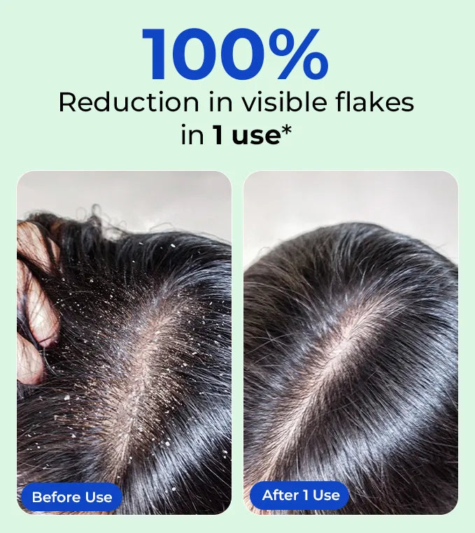 Product feature image 1