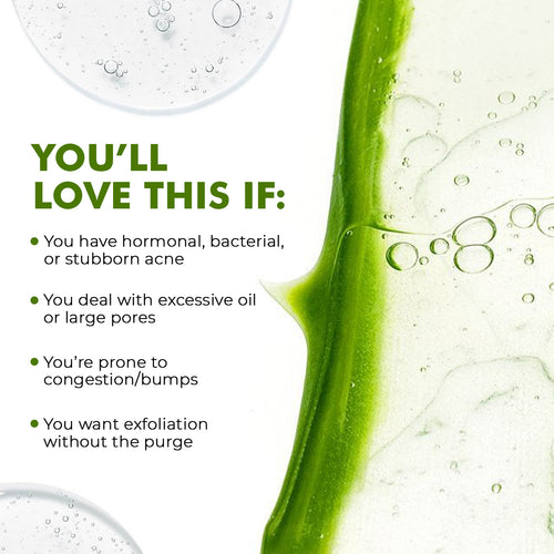 FlashFix Acne Treatment Serum | 2% Salicylic Acid & Willow Bark | 30 ml | Flash Sale