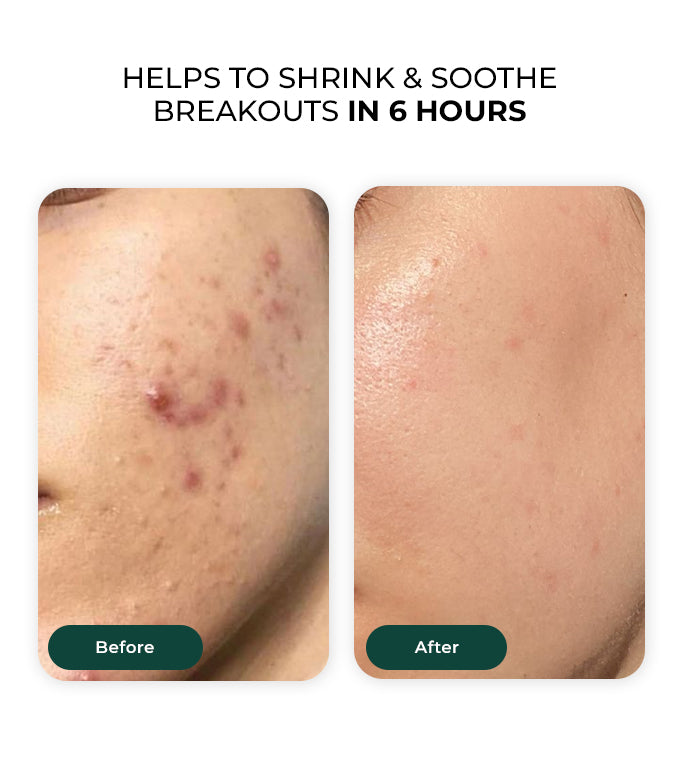 Comparison between our product and others