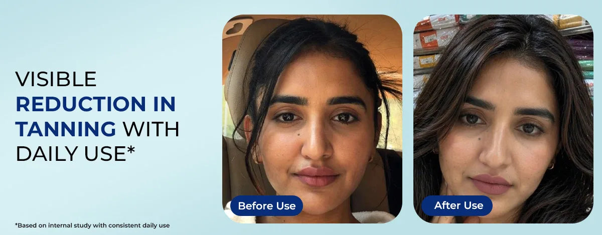 Product feature image 1