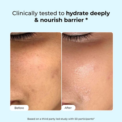 Hydrating Face Wash For Dry Skin | Hyaluronic Acid & Ceramides | 100 ml