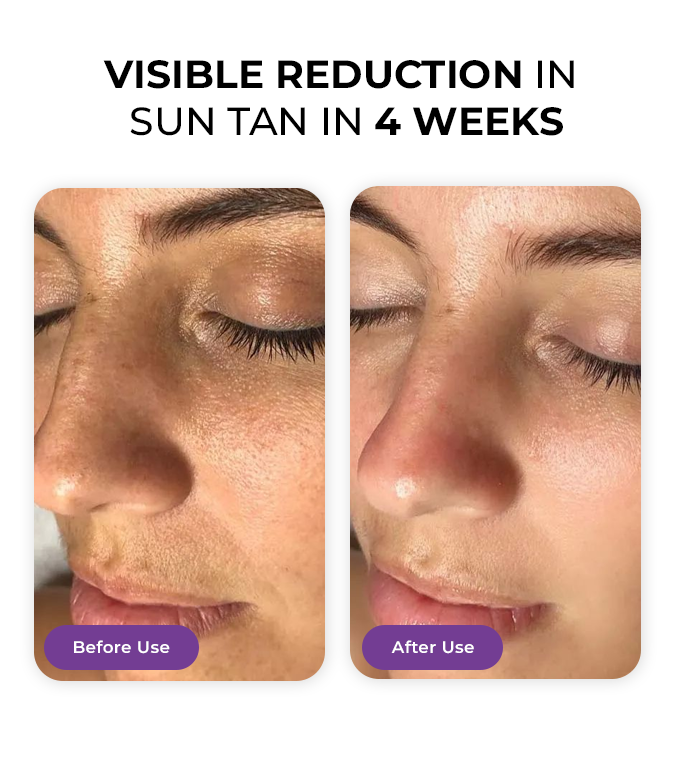 Product feature image 1