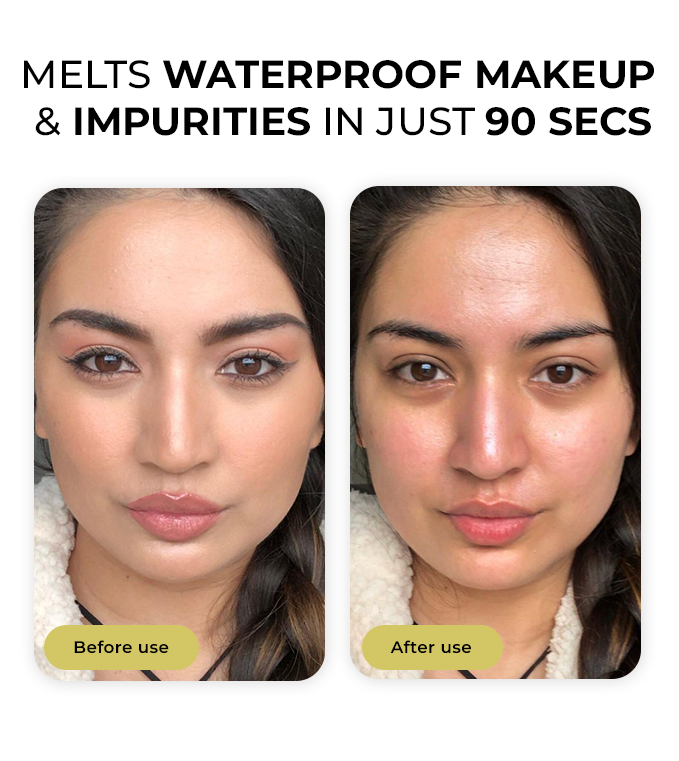 Comparison between our product and others