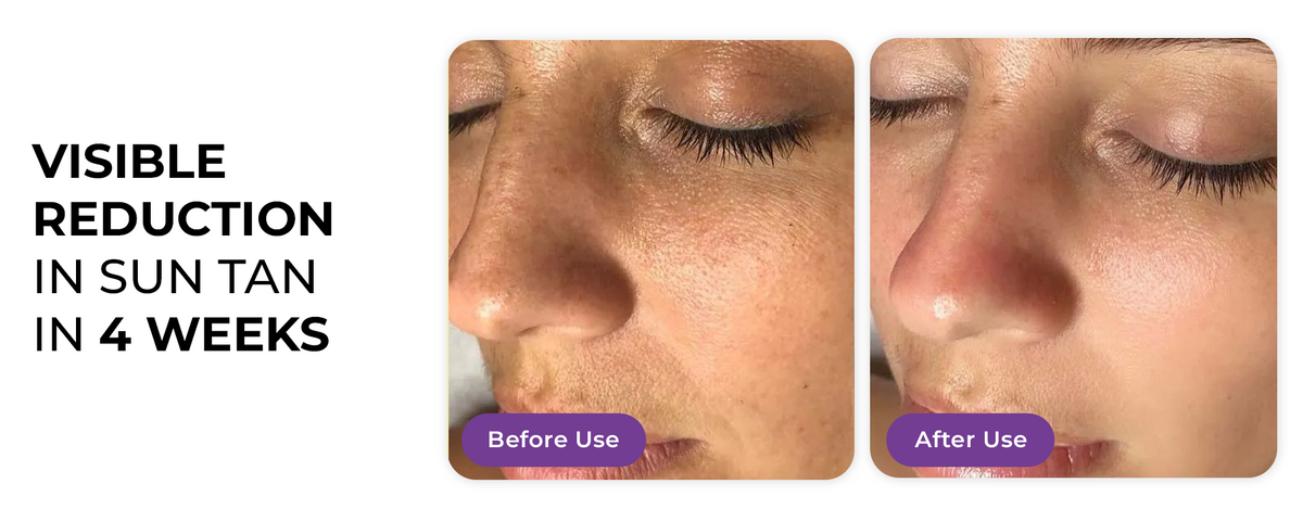 Product feature image 1