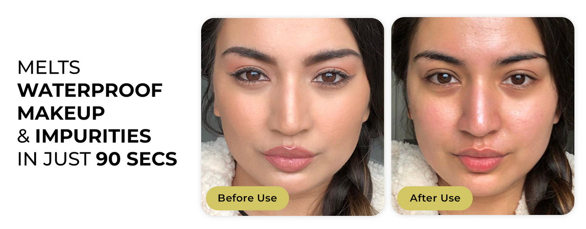 Comparison between our product and others