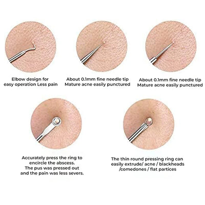 Blackhead Remover Tool | Toolkit | Mini Sale