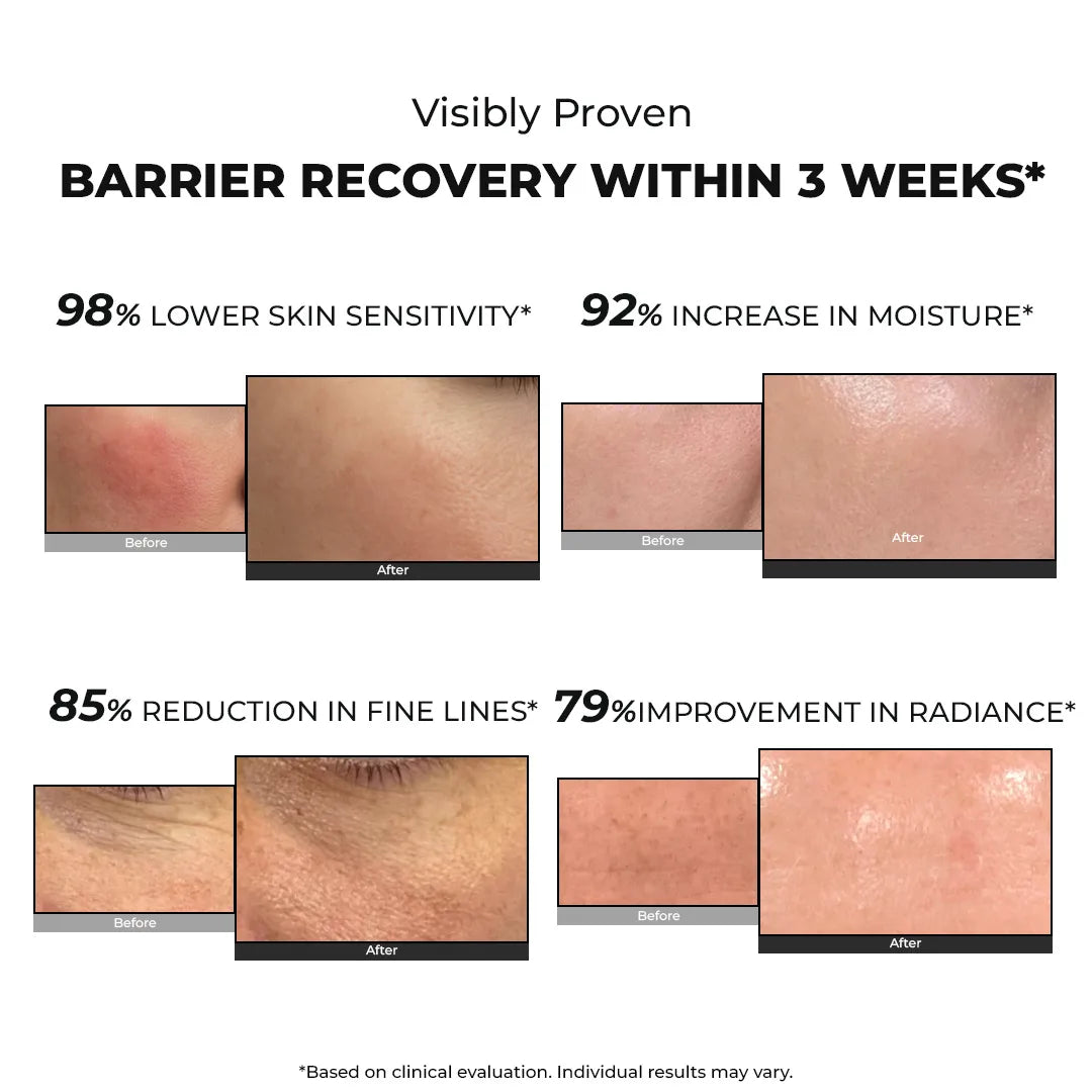 Snail Magic Barrier Repair | 50 Gms | Flash Sale