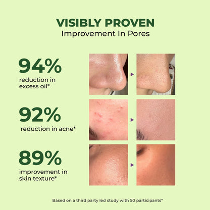 Oil Control & Acne Clearing Exfoliating Face Wash | AHA, BHA & CICA Extract | 100 ml