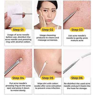 Blackhead Remover Tool | Toolkit | Mini Sale
