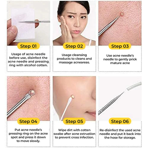 Blackhead Remover Tool | Toolkit | Mini Sale