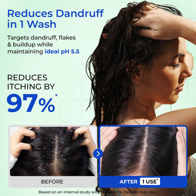 Anti-Dandruff Daily Care Duo | Shampoo & Conditioner