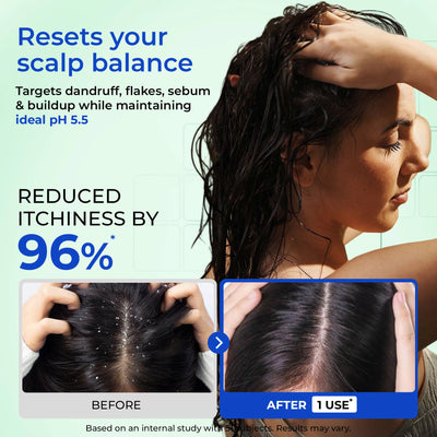 Anti-Dandruff Scalp Relief Duo | Scalp Exfoliator & Shampoo