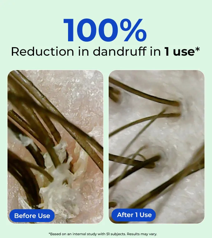 Product feature image 1