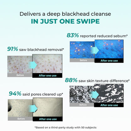 Blackhead Melting Water | 130 ml | Pre-Access
