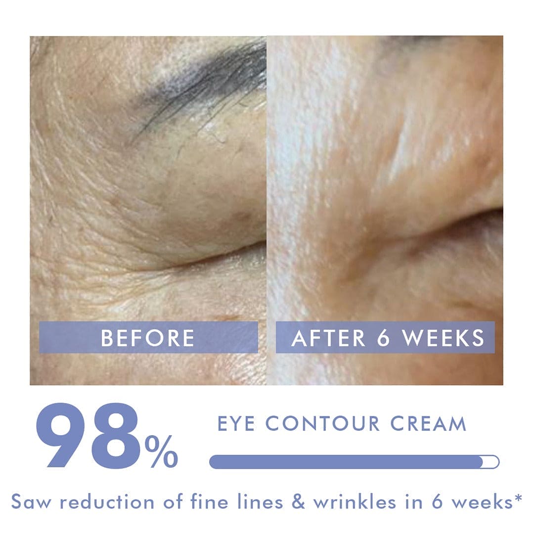 Eye Contour Treatment | Relieves Dark Circles, Puffiness & Fine Lines