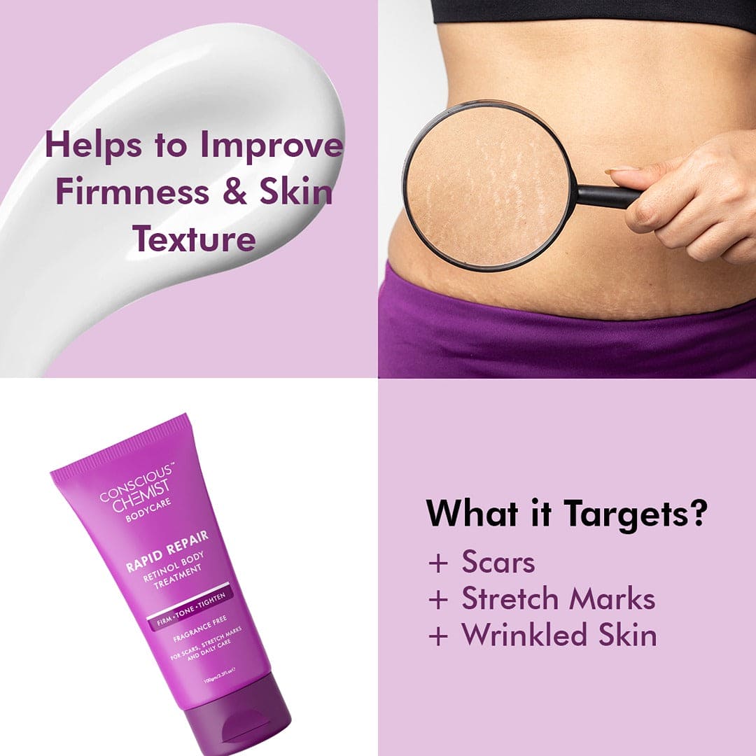 Resurfacing Body Cream for Stretch Marks, Fine Lines & Wrinkles