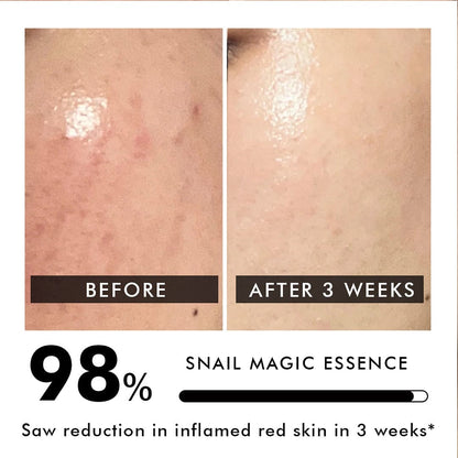 Snail Magic Essence | Barrier Repair | 97% Korean Snail Mucin