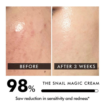 Snail Magic Moisturizer | Multi-solution moisturizer for skin renewal and repair | Combats fine lines and wrinkles