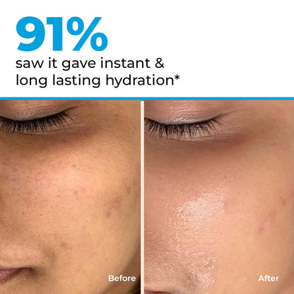 Hydro+ Multi Hyaluronic Acid Moisturiser | 100 gm