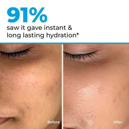 Hydro+ Multi Hyaluronic Acid Moisturiser |100 gm | Flash Sale