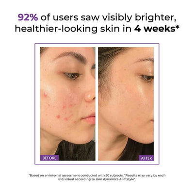 Brightening & Sun Protection Skincare Set