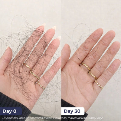 Anti-Hairfall Shampoo | Best Deal