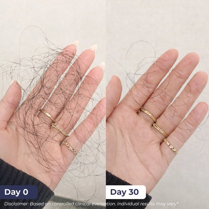 Anti-Hairfall Shampoo | 200 ml