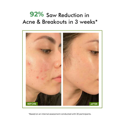 Oil Control & Acne Clearing Exfoliating Face Wash | AHA, BHA & CICA Extract | BS