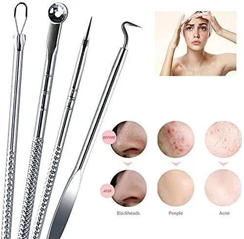 Blackhead Remover Tool | Toolkit
